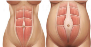 Welke Buikspieroefeningen Mag Ik Doen Tijdens Mijn Zwangerschap